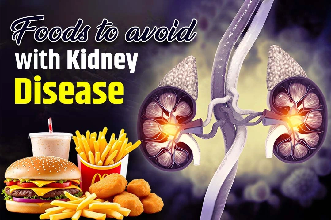 Foods to Avoid with Kidney Disease